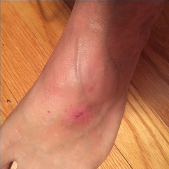 🛍️ Lg 4 oz Miracle Healing Balm, SUNDAY NIGHT SALE!! #momma #elevatedskincare - Picture 10 of 16